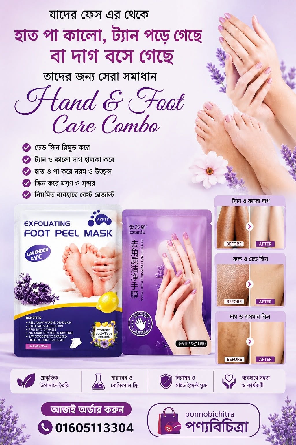 Before and after foot heel result